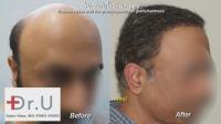 Dr U Hair & Skin Clinic image 5
